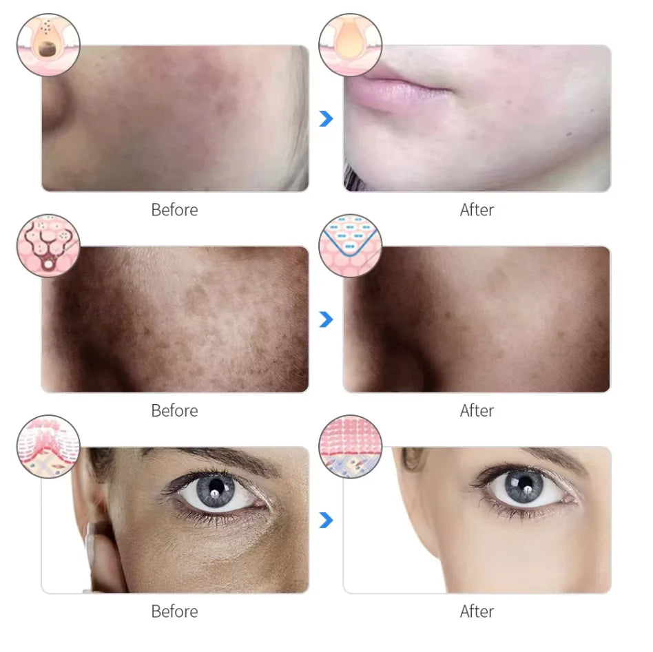 7-Color LED Light Therapy Face Mask – Skincare Made Simple