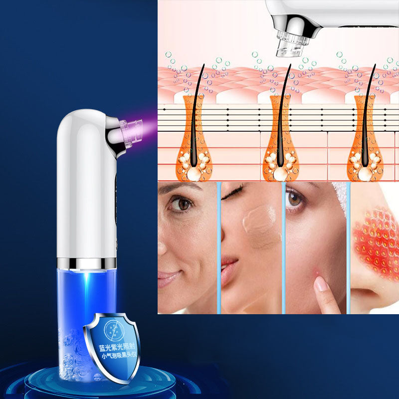 Microdermabrasion Deep Cleansing Blackhead Remover
