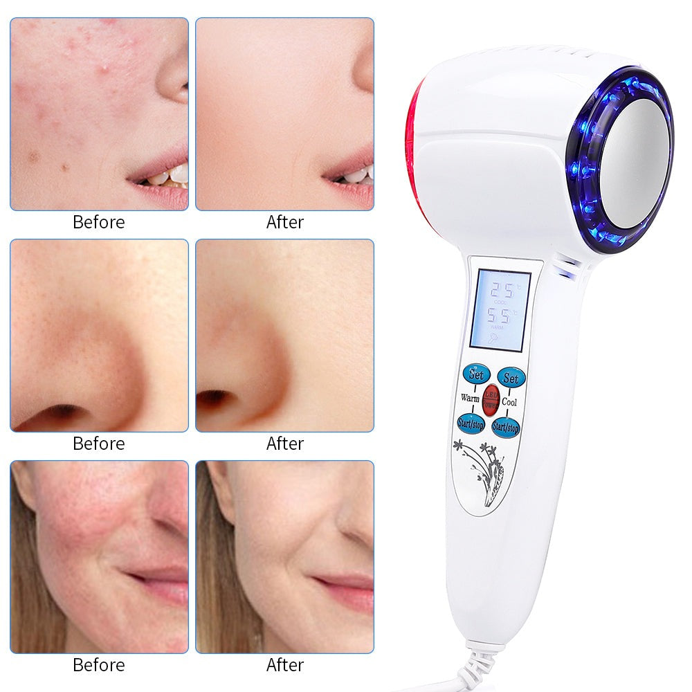 At-Home Facial Cryotherapy Device