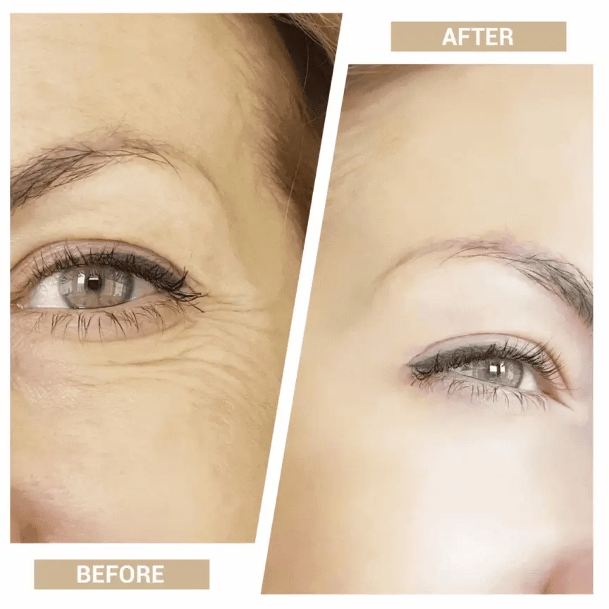 7-in-1 Face & Neck Sculpting Massager with Red Light & Vibration Therapy