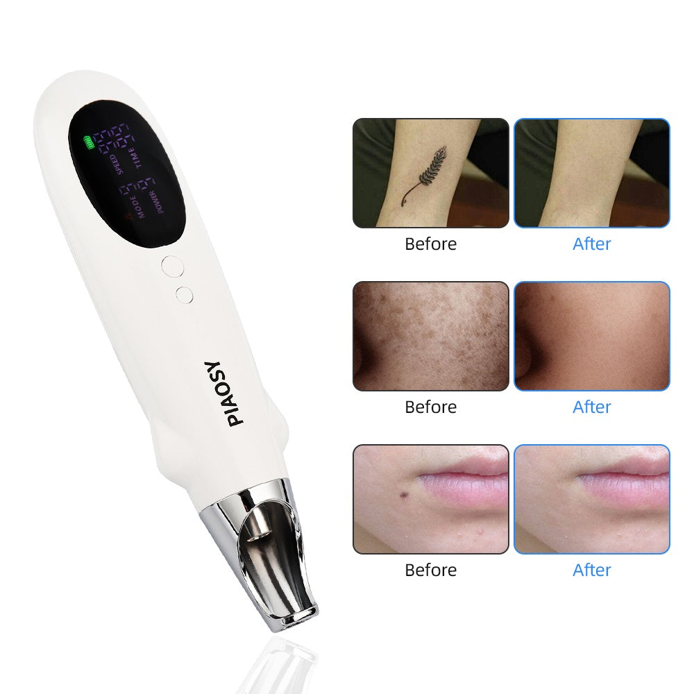 Picosecond Pen for Tattoo, Dark Spot & Acne Scar Removal