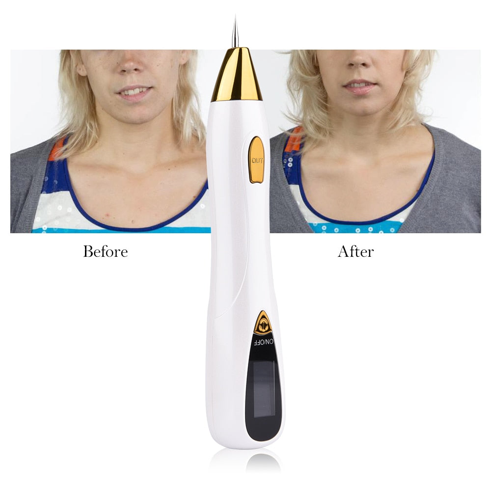 Mole Removal Pens