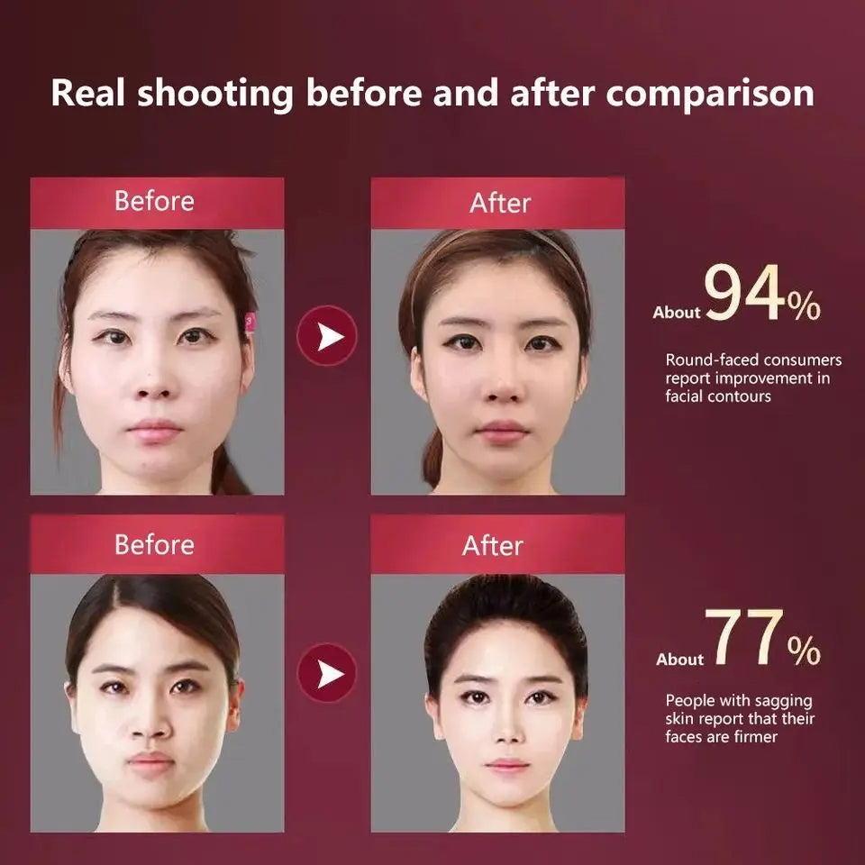 Vibration Slimming Massager for Double Chin & V-Shape Face