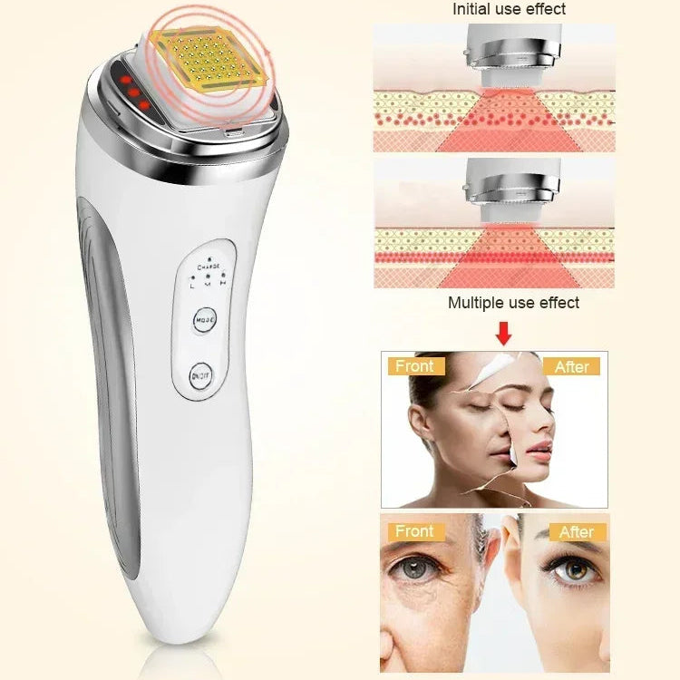 Dot Matrix Facial Lifting & Skin Rejuvenation Device