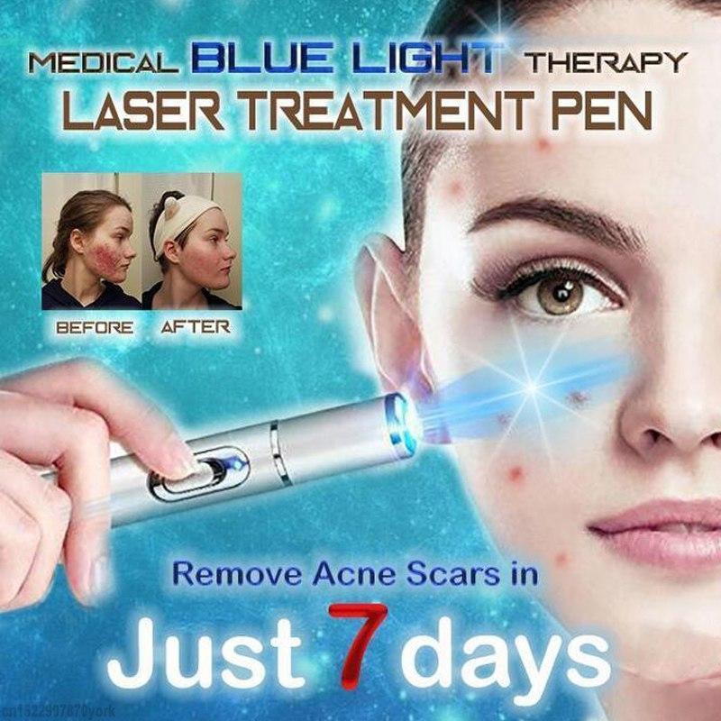 Spider Veins Removal Pen - Blue Light Therapy Laser Pen For Varicose Veins