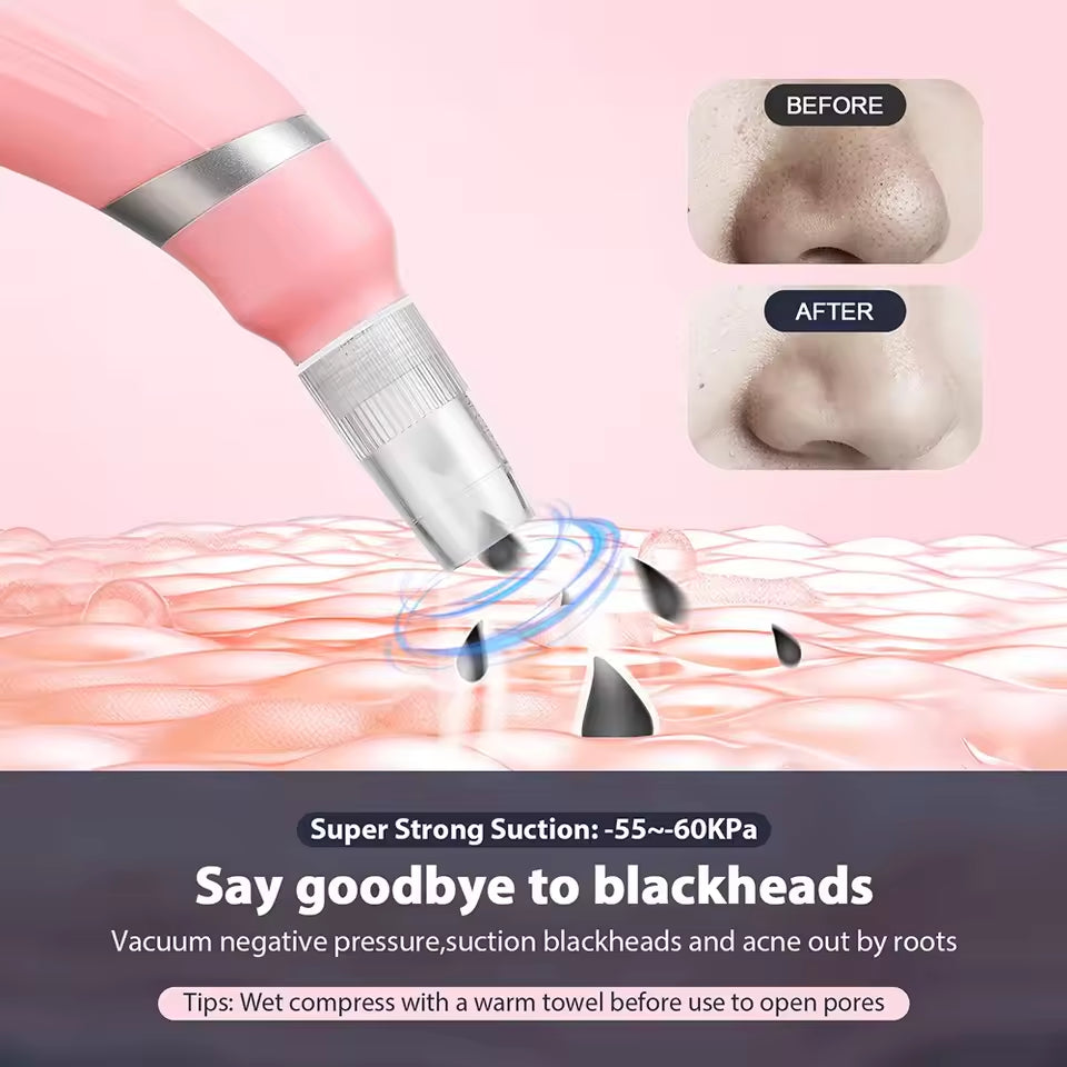 Microdermabrasion Pore Cleaner for Radiant Skin