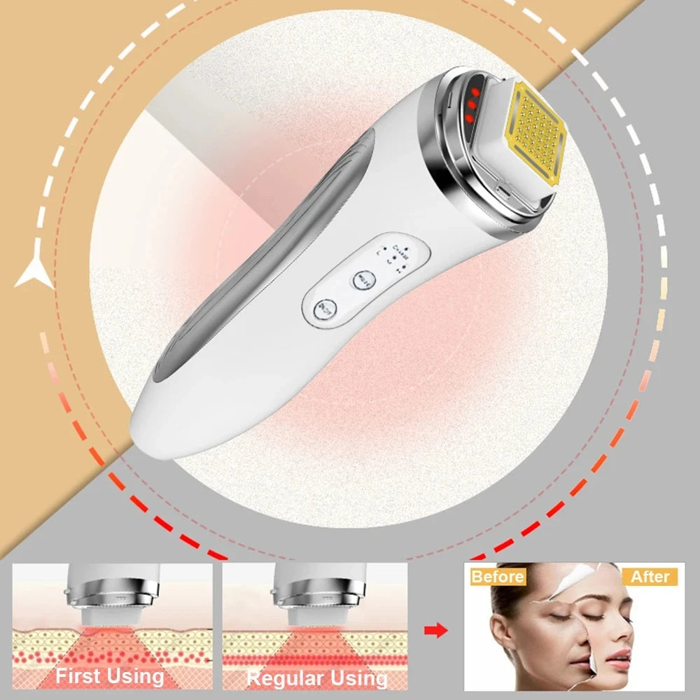 Dot Matrix Facial Lifting & Skin Rejuvenation Device