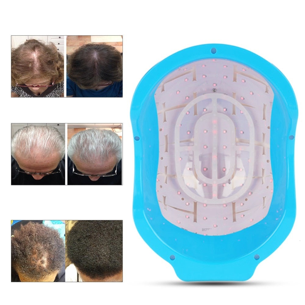 Laser Hair Regrowth Helmets