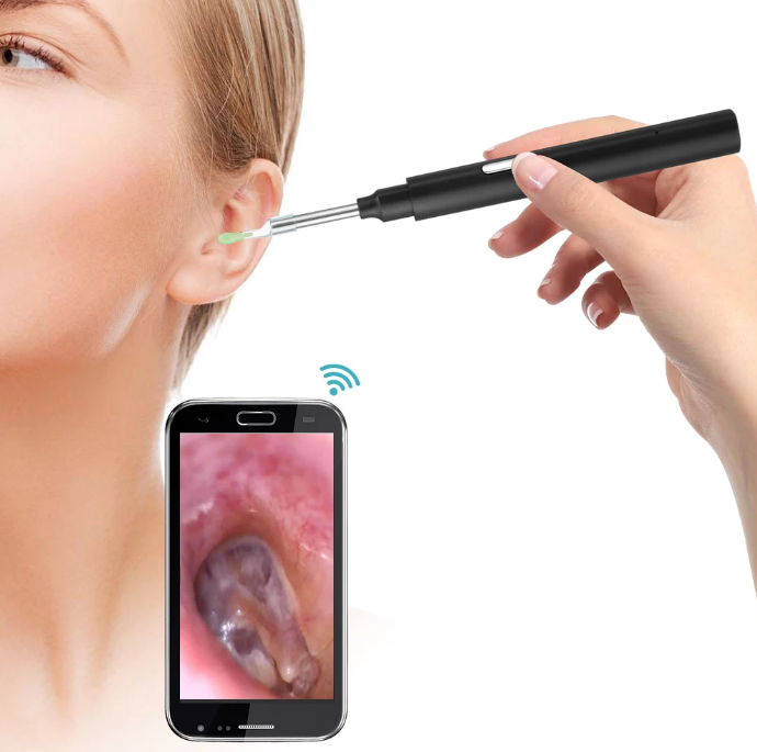 WiFi Tool Cleaning Camera Ear Wax Removal 3MP Waterproof Wireless LED Light