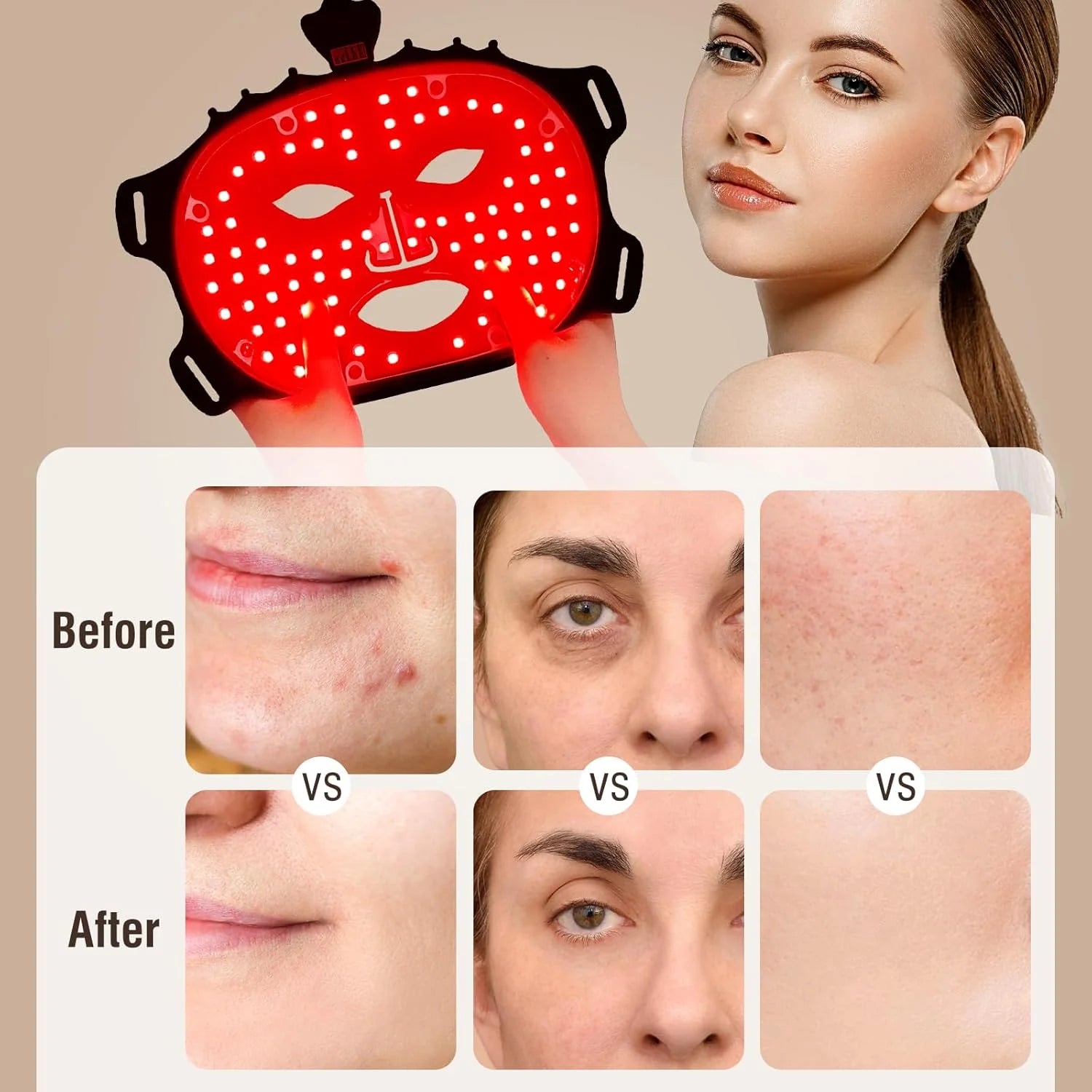 LED Light Therapy Face Mask – 7 Colors for Skin Gen 2.0